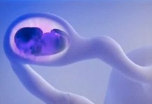 Программа "Здоровье" от 4 июля 2009 г.