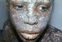 Программа "Здоровье" от 4 декабря 2004 г.