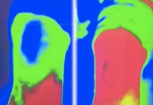 Программа "Здоровье" от 6 января 2003 г.