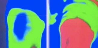 Программа "Здоровье" от 6 января 2003 г.