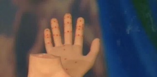 Программа "Здоровье" от 6 апреля 2002 г.