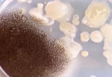 Программа "Здоровье" от 8 мая 2004 г.