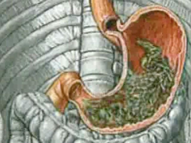 желудок человека изнутри. желудок человека изнутри. желудок человека изнутри. желудок человека изнутри. желудок человека изнутри.