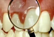 Программа "Здоровье" от 9 октября 2004 г.