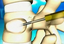 Программа "Здоровье" от 10 ноября 2007 г.
