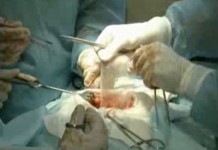 Программа "Здоровье" от 11 декабря 2004 г.