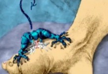 Программа "Здоровье" от 17 февраля 2007 г.