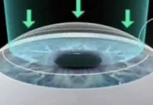 Программа "Здоровье" от 20 октября 2007 г.