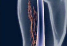 Программа "Здоровье" от 23 октября 2004 г.