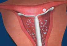 Программа "Здоровье" от 24 января 2004 г.