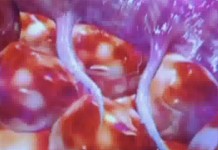 Программа "Здоровье" от 30 сентября 2006 г.