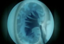 Первая помощь пострадавшим при обрушении здания