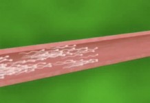 Мужское бесплодие