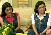 Сиамские близнецы: жизнь по отдельности