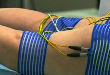 Процедура миостимуляции