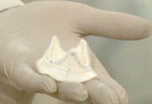 Биологические клапаны сердца