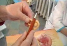 Что такое стерилизация