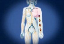 Новый метод лечения лимфостаза