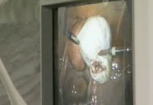 Удаление миомы матки