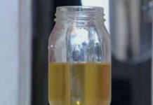 Уринотерапия