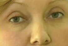 История Валентины Филипповны