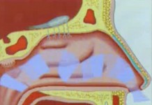 Чем опасен насморк