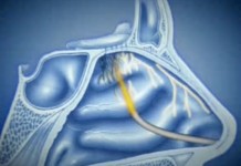 Потеря обоняния