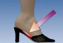 Чем опасна неправильная обувь