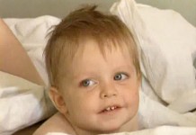 Удаление опухоли прямой кишки (1 часть)