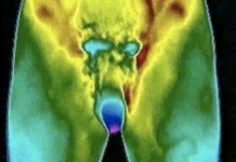 Мужская потенция: безвыходных ситуаций нет