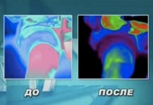 Боль в суставах