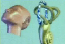 Расстройства вестибулярного аппарата