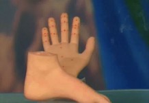 Су Джок терапия