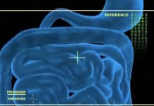 Как бороться с запорами