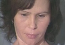 Синдром сухого глаза