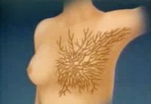 Программа "Здоровье" от 27 ноября 2004 г.