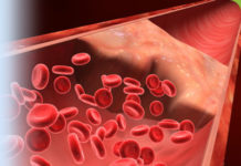 Что вы знаете о холестерине?