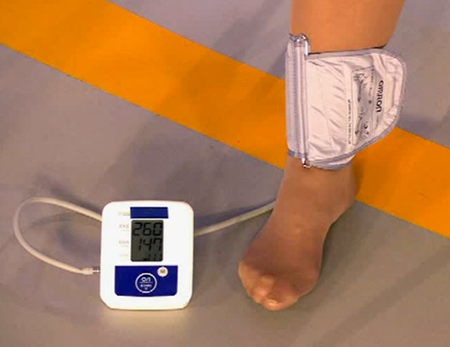 Разница ад на руках. Измерение давления на ногах. Измерение артериального давления на ногах. Как измерить давление на ноге.