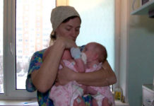 Рождение сиамских близнецов