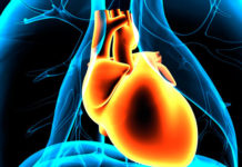 Гипертрофическая кардиомиопатия