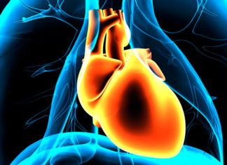 Гипертрофическая кардиомиопатия