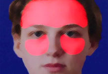 Программа «Жить Здорово» от 15.03.2017: Синусит (гайморит). Небезобидные последствия насморка