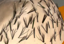 Программа «Жить Здорово» от 03.03.2017: Волосы. Инструкция по применению