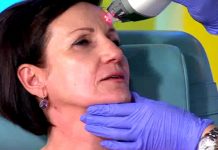 Программа «Жить Здорово» от 31.05.2017: Лазерный пилинг. Как вернуть лицу молодость