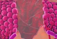 Программа «Жить Здорово» от 04.05.2017: Что делать, если вы поранились. Как помочь себе