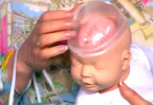 Программа «Жить Здорово» от 10.08.2017: Роковое наследство: глиома