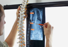 Как лечат ранние и поздние стадии сколиоза?