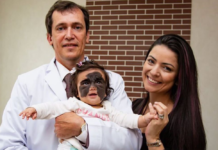 Результат на лицо: мама девочки с «маской Бэтмена» — о лечении в России