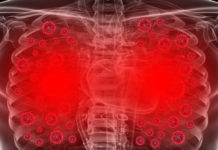 Врач назвал первые признаки поражения лёгких