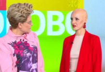 Программа «Жить здорово» от 20.04.2021: Другая красота. Алопеция